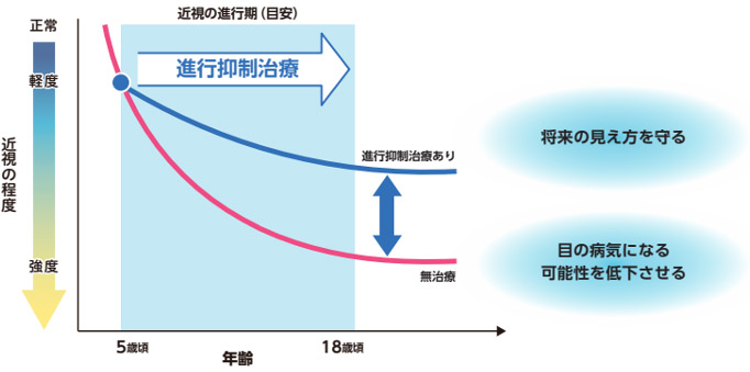 リジュセア® ミニ点眼液 0.025%｜けいら眼科クリニック（上永谷駅から